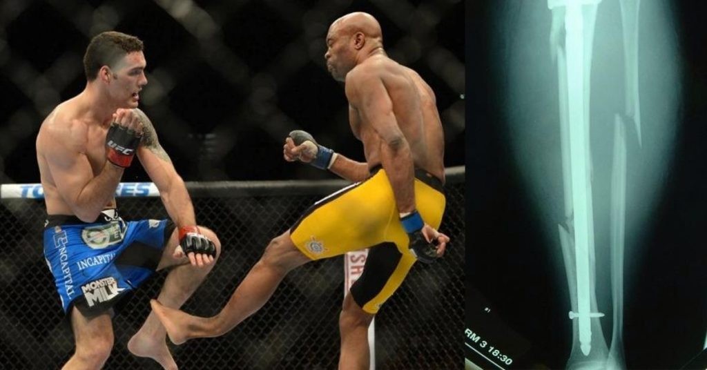 How Did Anderson Silva Break His Leg - The Horrific Story Behind UFC 168