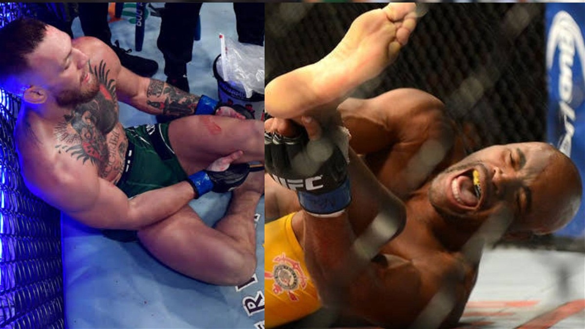 Conor McGregor leg injury and Anderson Silva leg injury