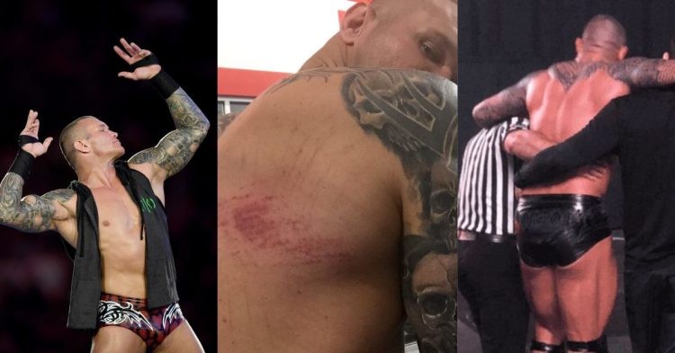 WWE Concerned About the Health of a 14-Time World Champion Randy Orton