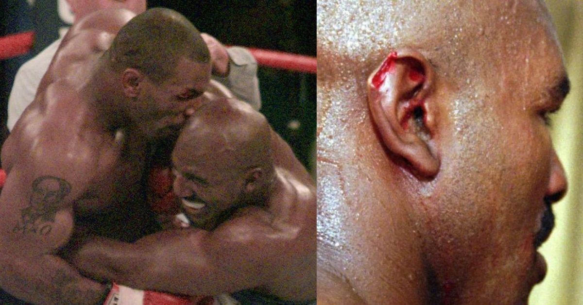 Mike Tyson bit off Evander Holyfield's ear