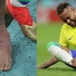 Neymar's injured ankle (left) Neymar goes down after being fouled during the Brazil-Serbia clash in the 2022 FIFA World Cup (right)
