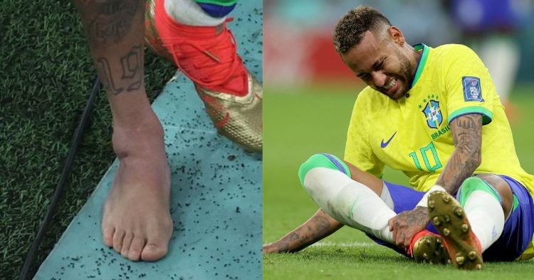 Neymar's injured ankle (left) Neymar goes down after being fouled during the Brazil-Serbia clash in the 2022 FIFA World Cup (right)
