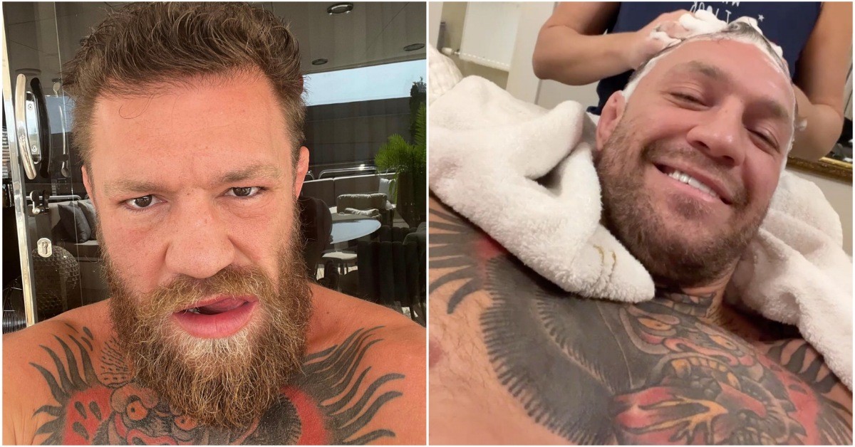 Conor McGregor's decreasing hairline