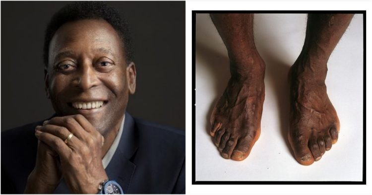 Pelé (left) and his feet.