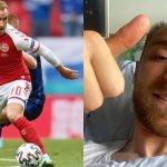 Christian Eriksen suffered a heart attack during a match against Finland in the Euros 2020