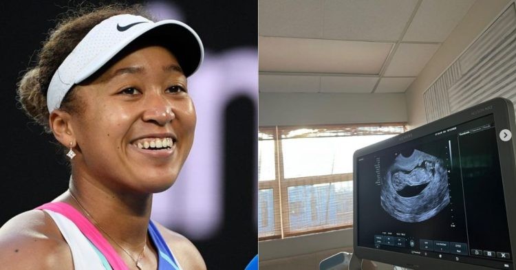 Naomi Osaka along with a Sonogram image of her baby (Credit: Instagram)
