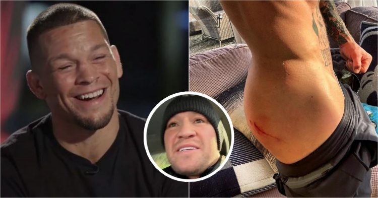 Conor McGregor injury after accident
