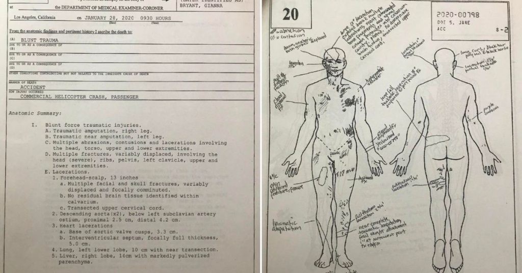 Gianna Bryant Autopsy Report Drawing What Caused Gigi's Horrific Death?