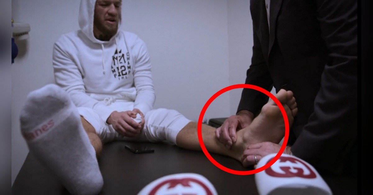 Conor McGregor injured ankle