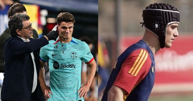 FC Barcelona star Gavi is wearing a headgear after suffering an ear injury