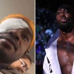 Errol Spence Jr. underwent cataract surgery (L) Terence Crawford (R)