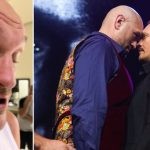 Tyson Fury pulls out of Oleksandr Usyk fight due to injury