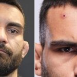 Benoit Saint-Denis has a staph infection on his forehead?