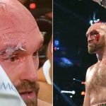 Tyson Fury cut above eye