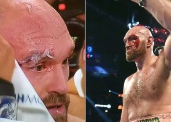 Tyson Fury cut above eye